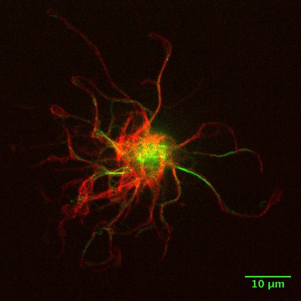 Microtentacles of non-cancerous epithelial cells. Tubulin is marked in red and vimentin in green. Photo courtesy of Lucina Kainka.