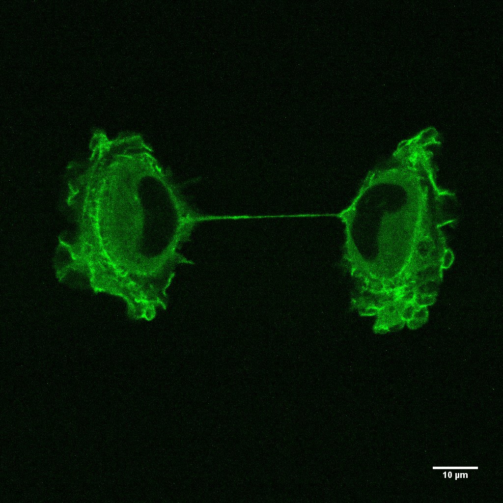 Non-cancerous epithelial cell during cytokinesis. Labeled is actin. Photo courtesy of Zahra Mostajeran.