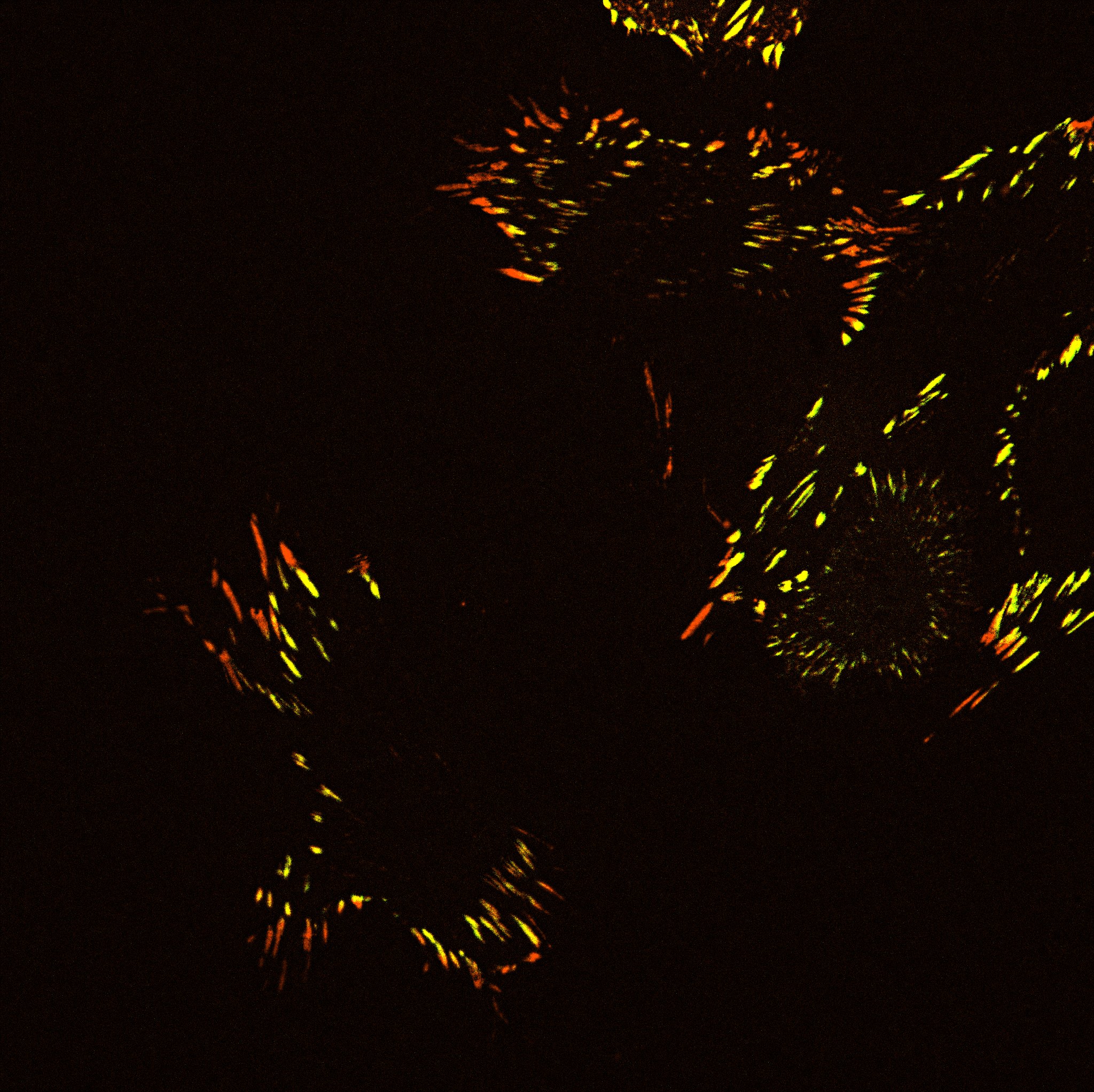 Focal adhesions of mouse embryonic fibroblasts after contact with the extracellular adherence protein (EAP) of the bacteria Staphylococcus aureus. Photo courtesy of Raphael Maser.
